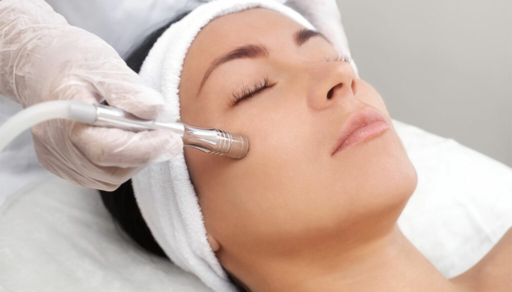 dermabrasion-helping-acne-scars