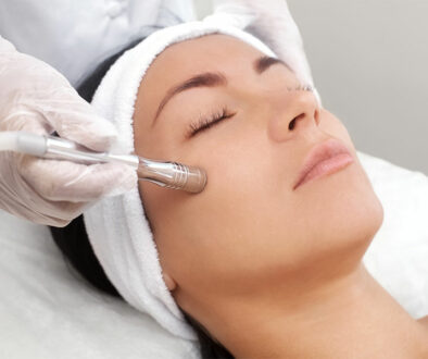 dermabrasion-helping-acne-scars