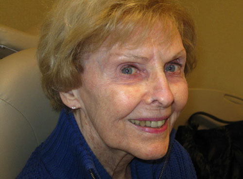 forehead flap post-op senior white woman